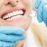 Closeup of a woman having her teeth examined at the dentist by a gloved hand holding a dental mirror