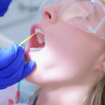 fluoride varnish application, treatment