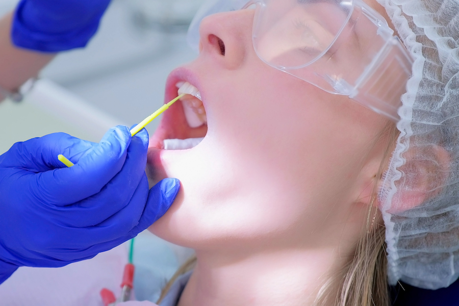 fluoride varnish application, treatment