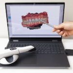 digital impression image in a dental office