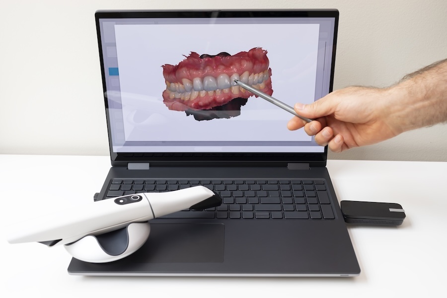 digital impression image in a dental office