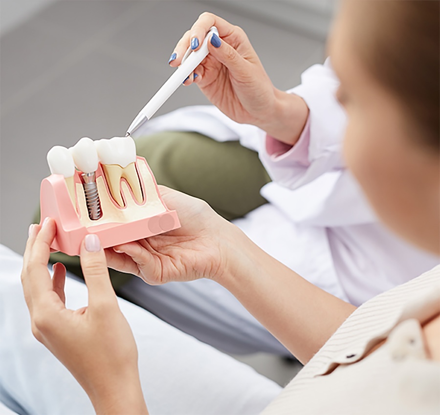 dental implant consultation for dental implant candidacy